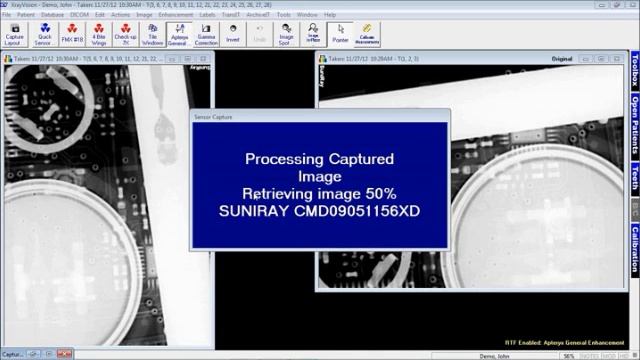11 Minutes Using Xray Vision for Dental Xrays смотреть онлайн