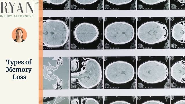 Memory Loss Following a Car Accident смотреть онлайн