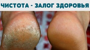 Нежная кожа стоп – это реально! Узнай, как достичь этого результата.