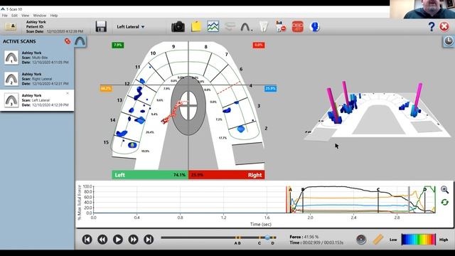 T-Scan Virtual Demonstration Featuring Dr. Ben A. Sutter смотреть онлайн