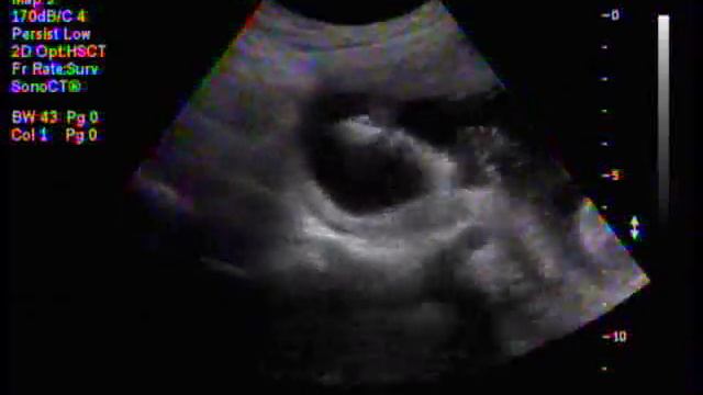 Morgan Robertson Ultrasound 4.21.09 Baby Boy смотреть онлайн