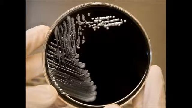 Legionnaires’ disease: A personal story смотреть онлайн
