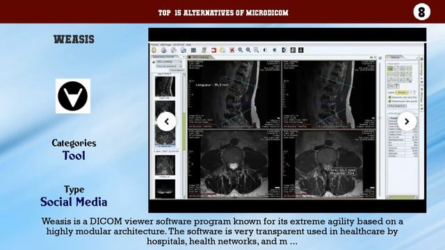 MicroDicom | Top 15 Alternatives of MicroDicom смотреть онлайн