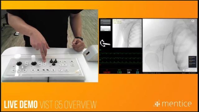 Mentice - VIST® G5 Overview & Simulation Basics смотреть онлайн