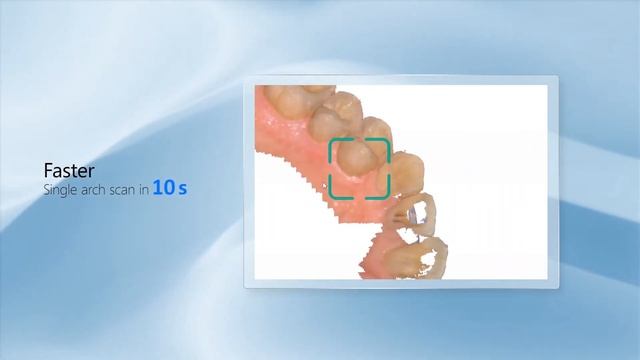 Aoralscan 3 - Intraoral Scanner IOS смотреть онлайн