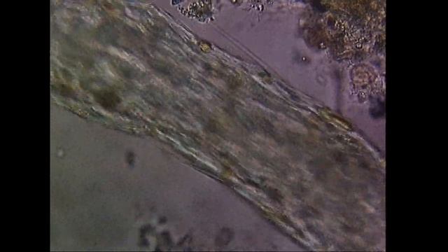 An Algae and a Rotifer walk into a bar, then all of a sudden "BAM!" in comes this Aeolosoma Monster смотреть онлайн