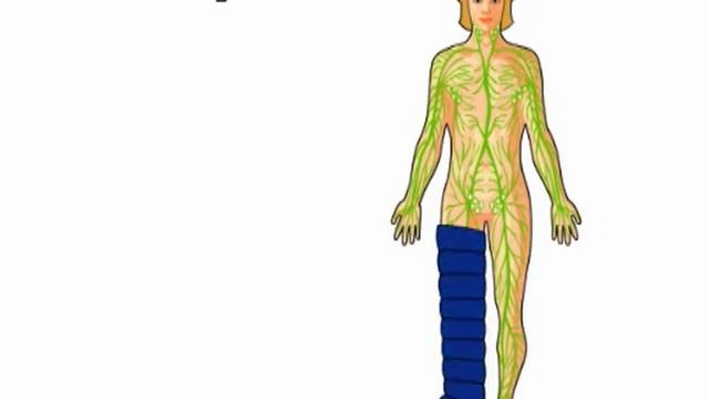 002 Lympha press optimal смотреть онлайн