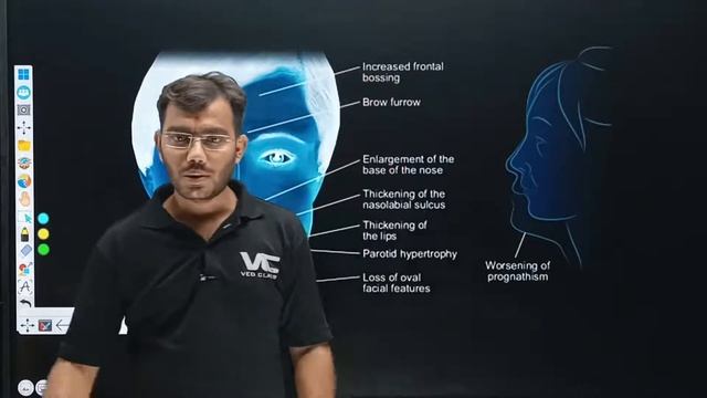 Chemical Coordination and Integration [Lecture - 1] By Sagar Sir | NEET2023 Chanakya Batch |VedClas смотреть онлайн