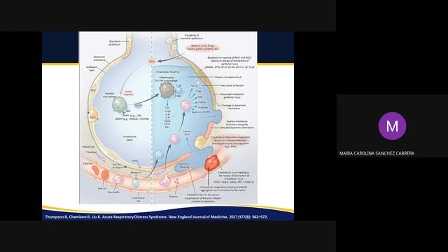 SDRA en pediatria смотреть онлайн