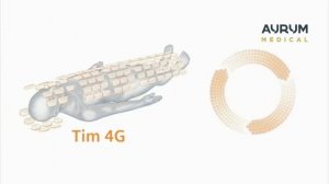 MAGNETOM Aera Siemens