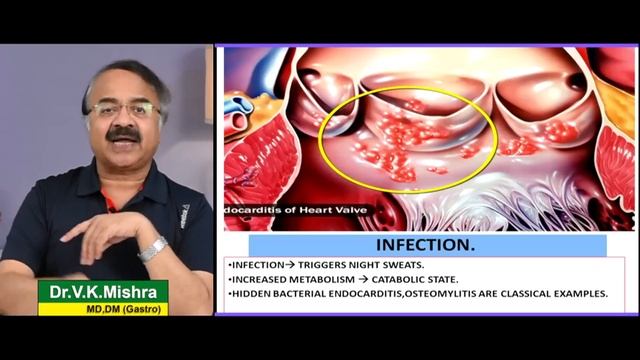 रात में पसीना - किस बीमारी के संकेत ? || WHAT CAUSES NIGHT SWEATS ? смотреть онлайн