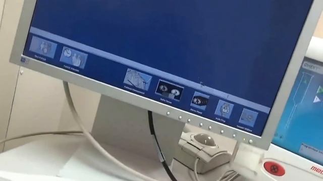 How Does a CT (CAT Scan) Work? смотреть онлайн