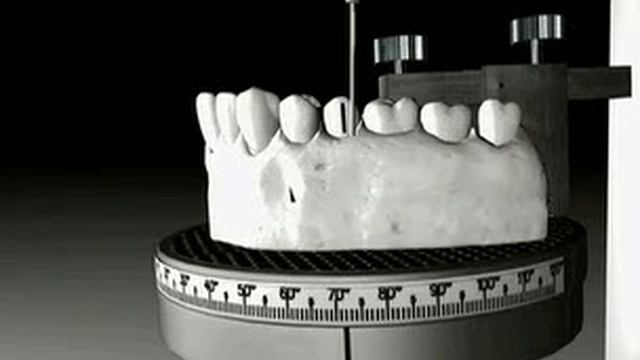 ray set orthodontics смотреть онлайн