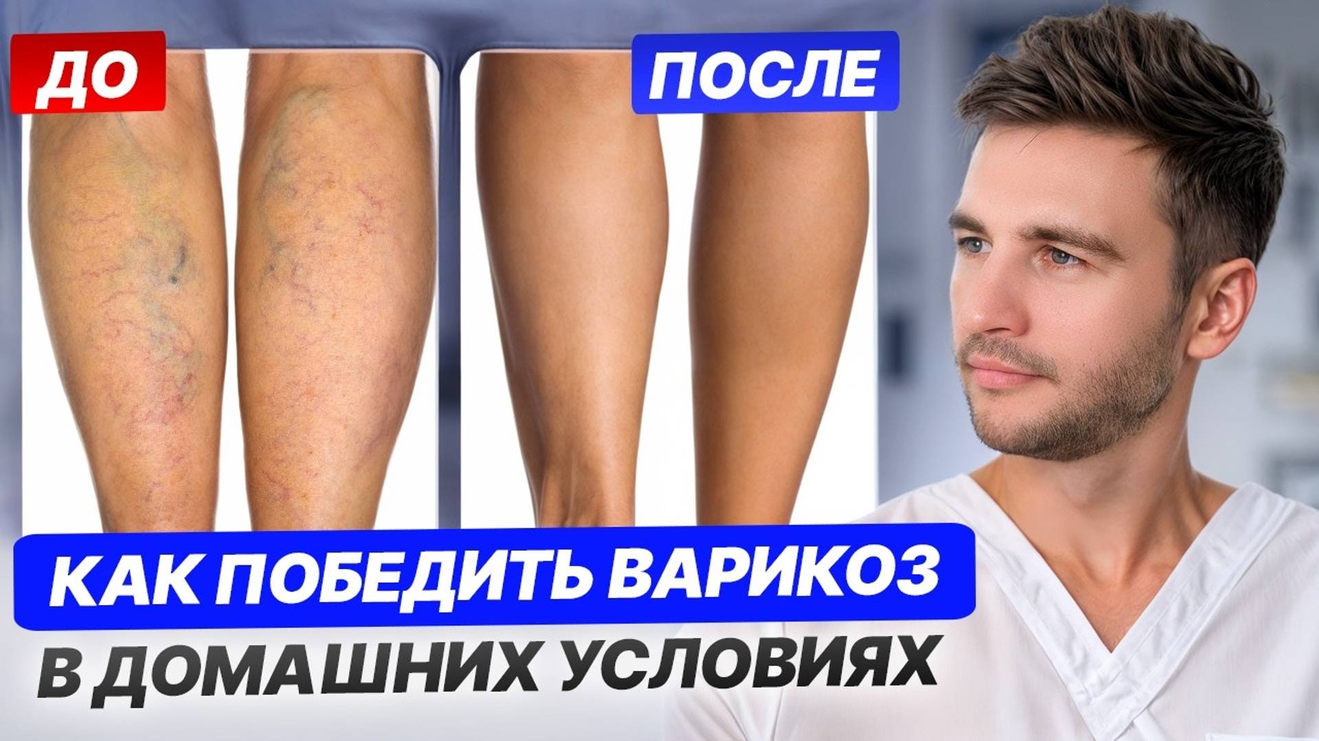 ВАРИКОЗ начнет уходить после ПЕРВОГО упражнения! / Как вылечить варикоз на ногах БЕЗ ОПЕРАЦИЙ? смотреть онлайн