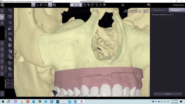 Измерение площади поверхности