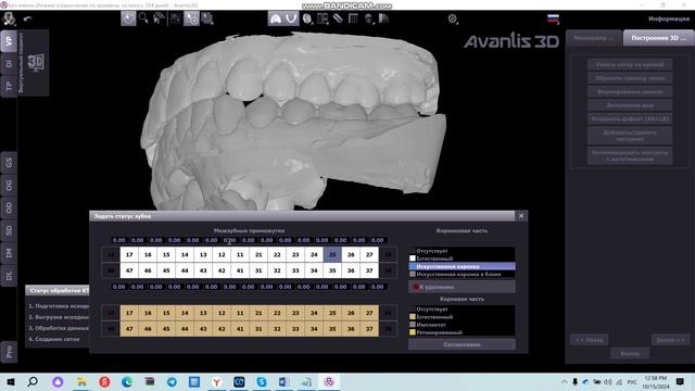 Задание статусов зубов