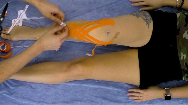 Запись_вебинара_Колено_фикс (720p) смотреть онлайн