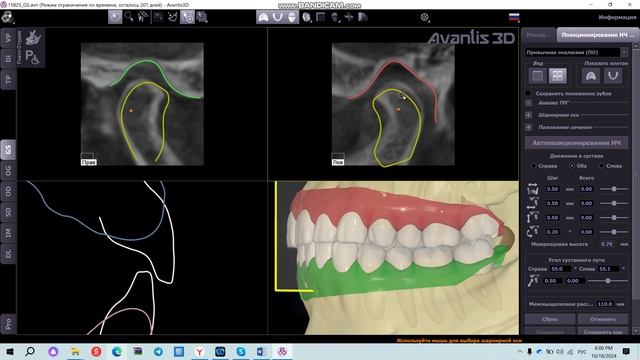 Позиционирование НЧ
