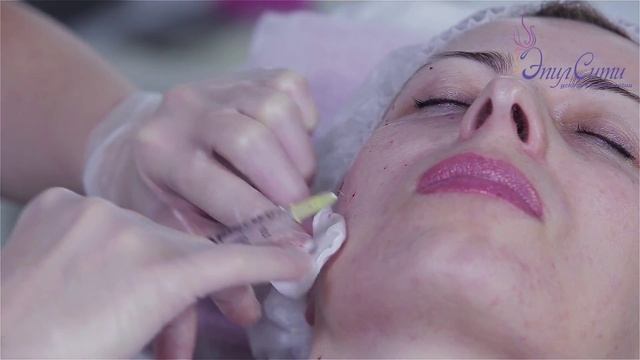 Мезотерапия. ЭпилСити о мезотерапии в Москве. Что это за процедура? Особенности мезотерапии.