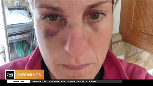 KCAL On Your Side: Avoiding VR headset injuries смотреть онлайн