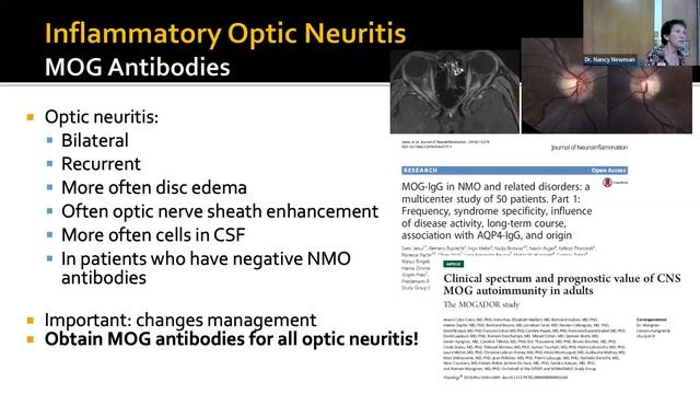 Grand Rounds. Neuro-Ophthalmology Update. Dr. Nancy Newman. 5/20/2022 смотреть онлайн