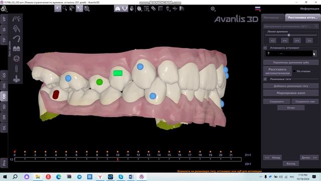 Расстановка аттачментов