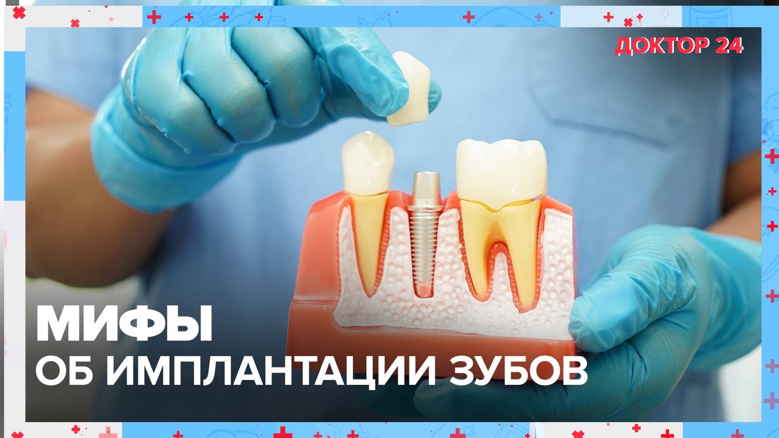 Мифы об ИМПЛАНТАЦИИ ЗУБОВ | Доктор 24 смотреть онлайн