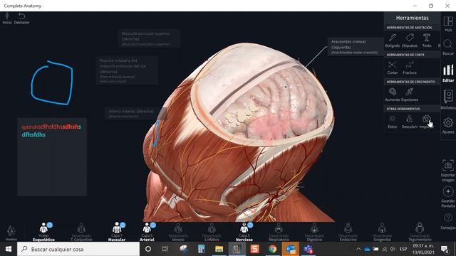 13 May 21, Complete Anatomy Basic, La plataforma de anatomía 3D más avanzada del mundo. смотреть онлайн