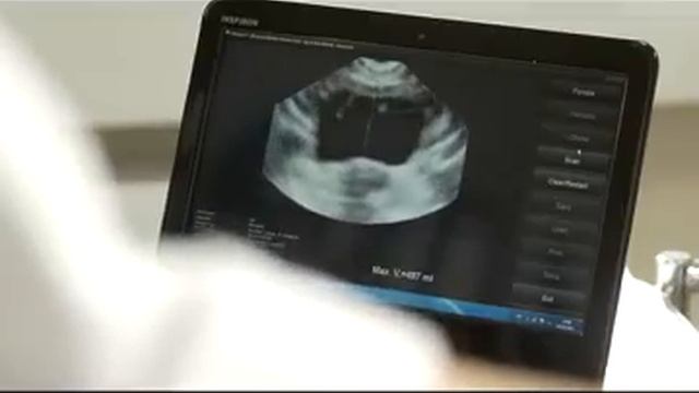 Scanmaster Kullanım - Ads Elektronik Tıbbi Cihazlar смотреть онлайн