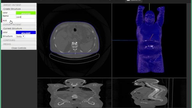 cloud dicom viewer смотреть онлайн