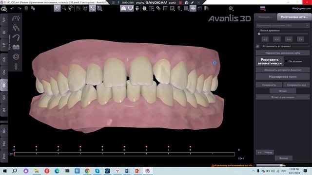 Авто-расстановка аттачментов