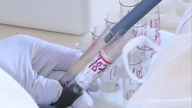 В Новом Уренгое увеличивается количество ВИЧ-инфицированных.