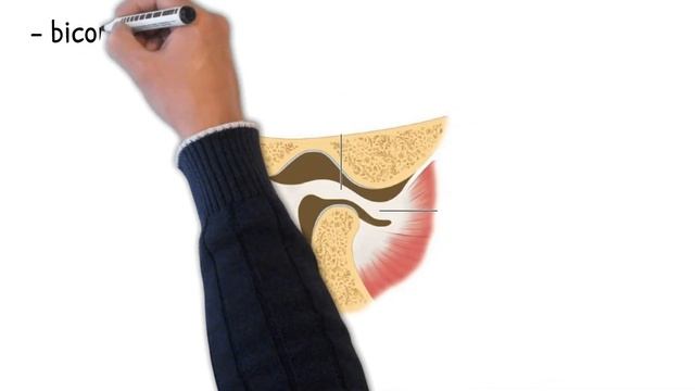 TMJ ANATOMY|DENTAL VIDEO|MEDICAL VIDEO|TEMPOROMANDIBULAR JOINT| смотреть онлайн