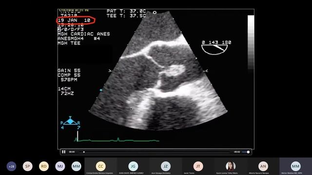 Conferencia: “Uso de RNM en caracterización de masas cardíacas” смотреть онлайн