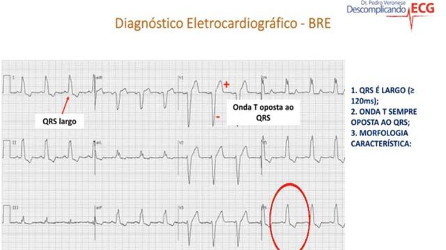 Dica de ECG: Síncope - Questão de Residência Comentada da Santa Casa - 01 смотреть онлайн