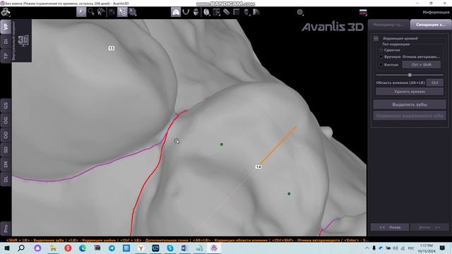 Выделение зубов