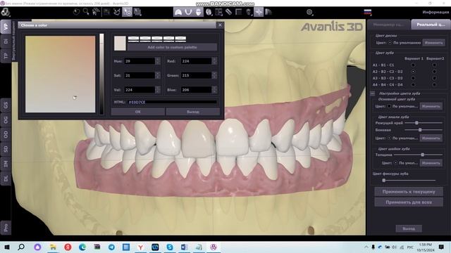Раскрашивание зубов и десны