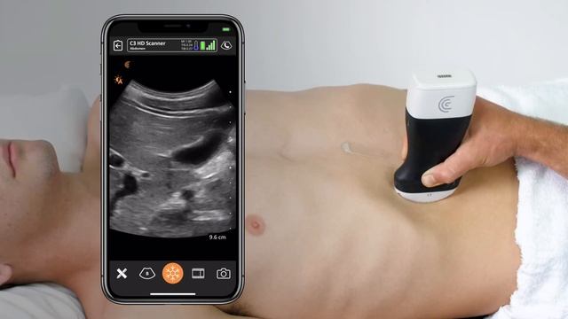 Scanning Technique: Gallbladder смотреть онлайн