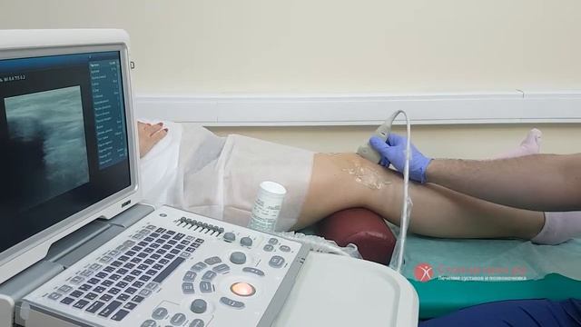 УЗИ коленного сустава