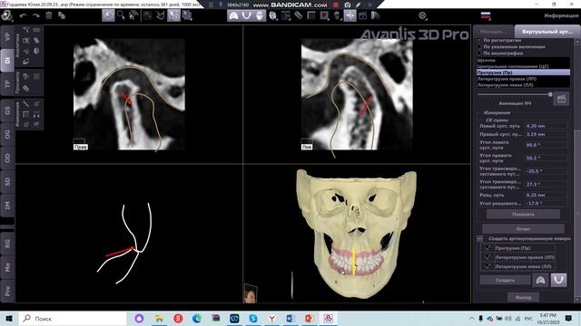 Артикуляционная поверхность