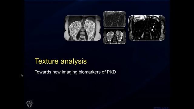 A conversation with Timothy Kline, Ph.D. смотреть онлайн