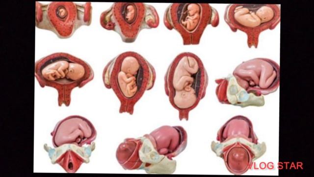 Pregnancy Ultrasound Me Placenta Grade 0,1,2,3,4 Ka Kya Matlb Hota He