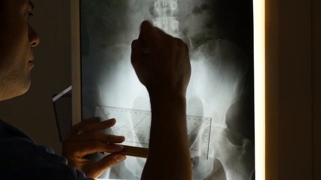 Spinal Decompression Therapy For Back Pain смотреть онлайн