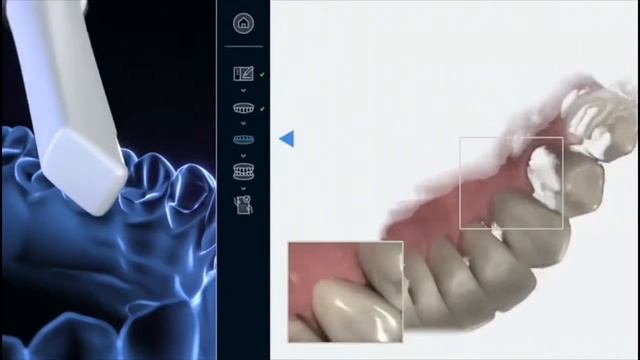 NEWTOM IOS смотреть онлайн