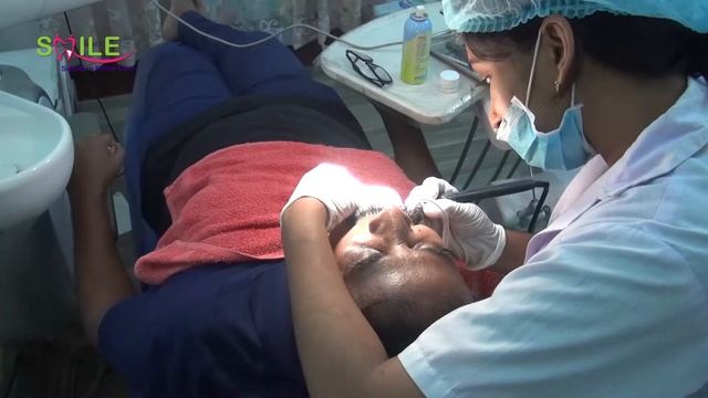 Dental Health Tooth scaling смотреть онлайн