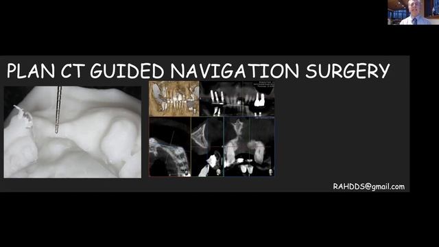 Bone grafts, barriers, growth factors and growth "enhancers" -Dr. Robert Horowitz смотреть онлайн