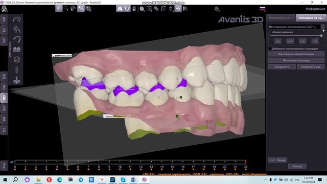 Расстановка накладок