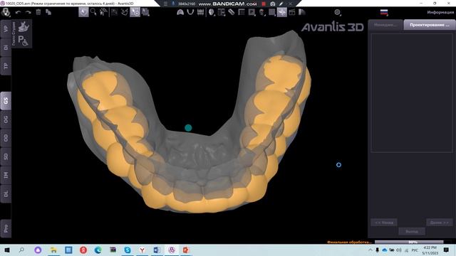 Автоматическое проектирование сплинта