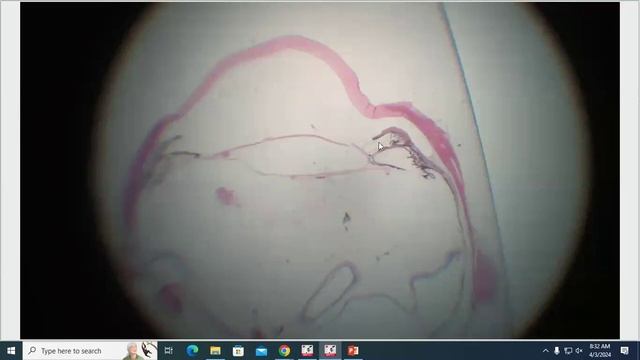 COPLOW Ocular Pathology Rounds April 3, 2024 смотреть онлайн