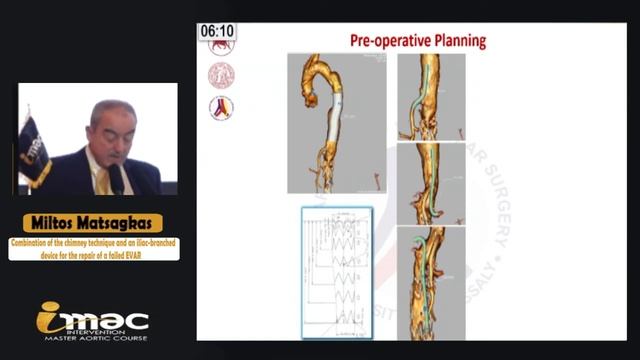 IMAC 2019 - Day 3 - Session 1 - Prof. Miltos Matsagkas - "B" смотреть онлайн